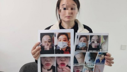 郑州一女子被企业家丈夫家暴最新进展：已要回孩子抚养权