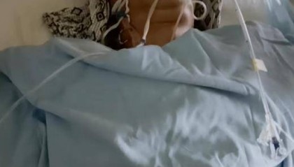 54岁男子夜钓时头部遭枪击，家属：中枪后他自己走回家，事发20余天仍昏迷不醒