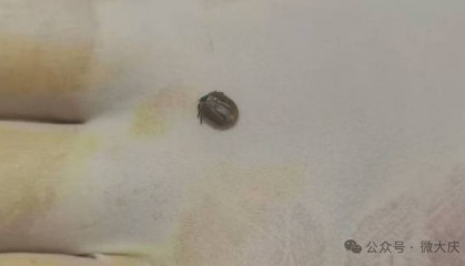 近期高发！黑龙江一医院接诊近20例！紧急提醒！